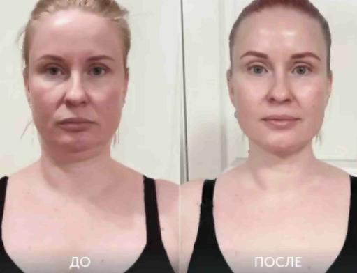 Face fit динамо